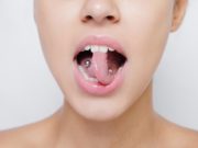 piercings-lengua-dientes-encías