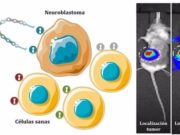 neuroblastoma quimioterapia