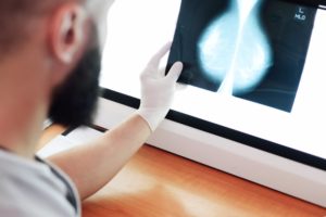 radiología-cáncer-mama-cirugía