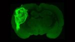 neuronas-humanas-in-vitro-in-vivo-ratas-estudio-stanford-2