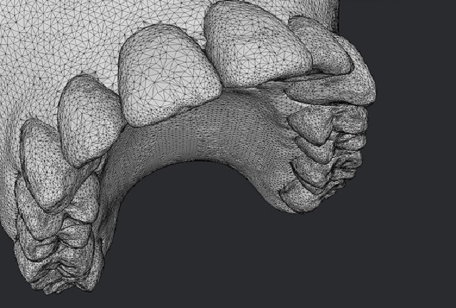 DentalMonitoring- imágenes-3D-remota