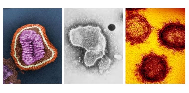 virus-gripe-vrs-covid-19-imagen-microscopio