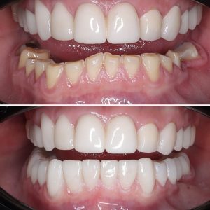 odontólogos-formación-estética-dental
