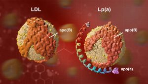 Lp(a)-elevada-riesgo-infarto