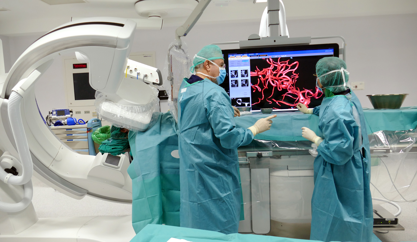 El tratamiento endovascular del aneurisma cerebral