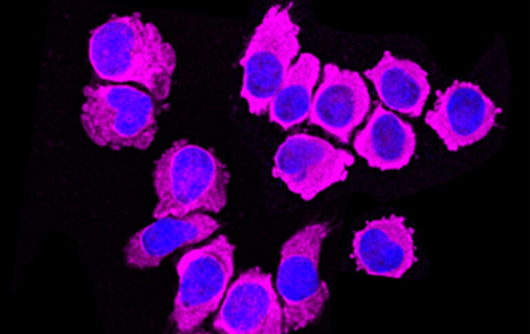 celulas-inmunes-humanas-alergia-ilc2-actividad-frente-cancer