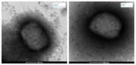 viruela-del-mono-imagen-virus-isciii