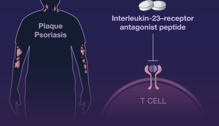 peptido-bloquea-il23-psoriasis