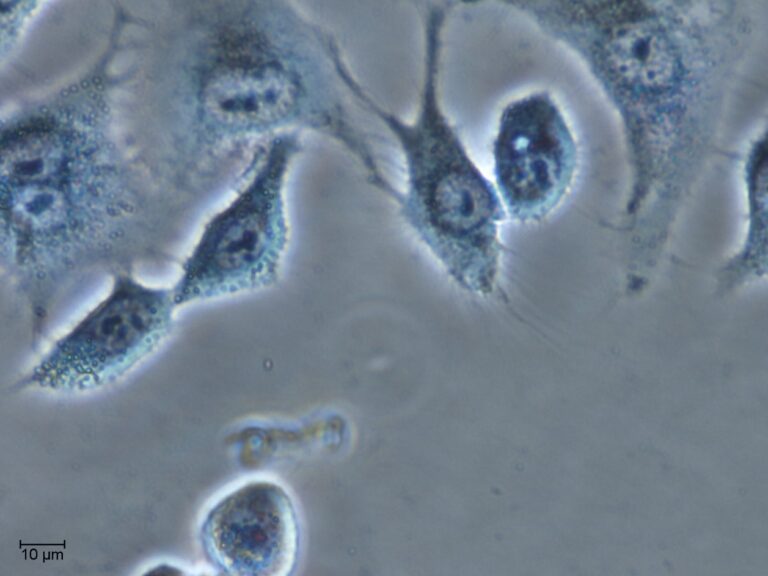 células-cancerosas-jaulas-moleculares