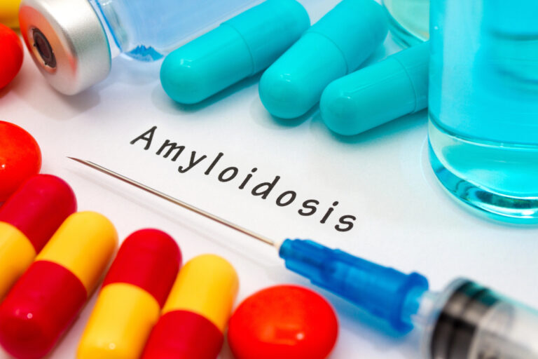 Amiloidosis