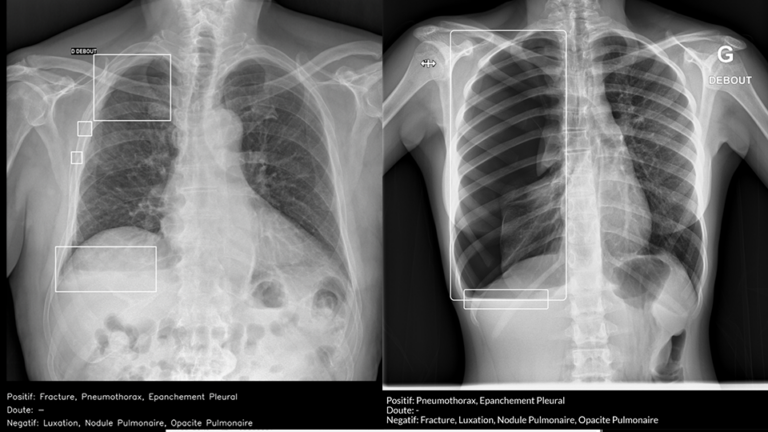 HM-IA-fracturas- urgencias