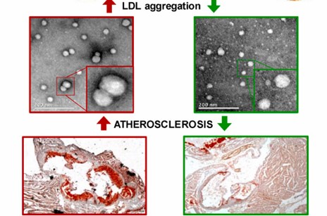 péptidos-ateroscleróticas-colesterol-LDL