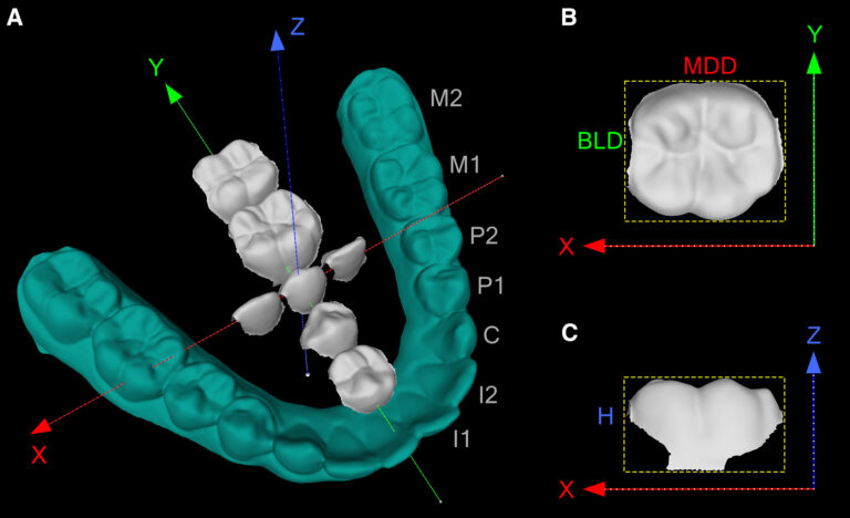 variantes-genéticas-forma-dientes