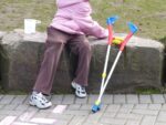 givinostat-distrofia-muscular-duchenne-becket