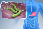Helicobacter pylori CSIC.