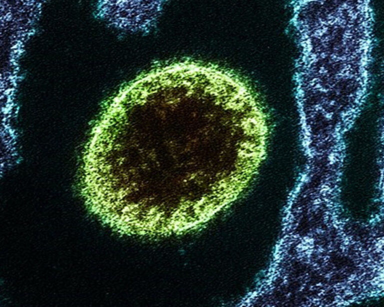 sanidad-remota-virus-nipah