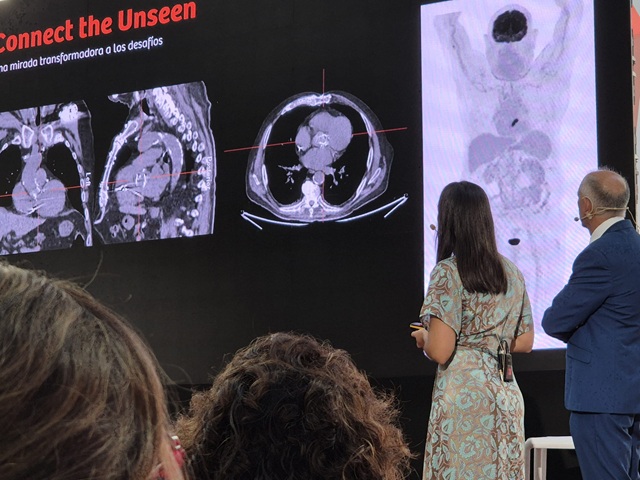 Believe-the-unseen-Siemens-Healthineers-radiología (2)