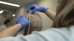 campos-eléctricos- inmunoterapia- glioblastoma