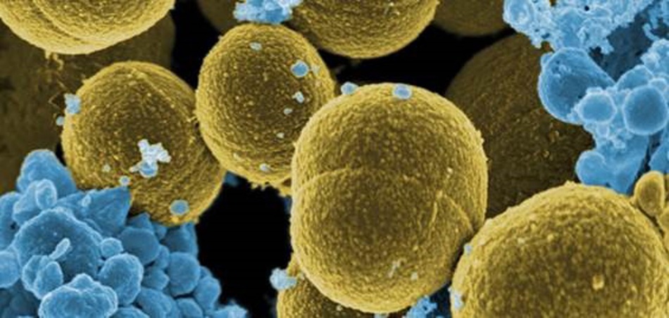 CSIC-materiales-antimicrobianos