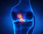 ligamento cruzado anterior