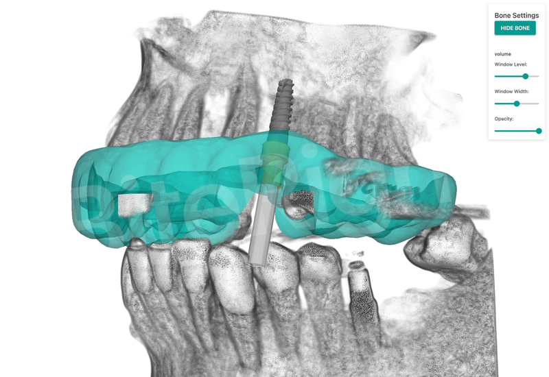 Institutos-Odontológicos- implantología-digital